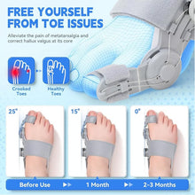 Load image into Gallery viewer, Upgraded Bunion Corrector
