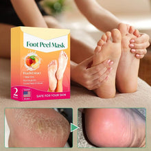 Load image into Gallery viewer, Exfoliating Foot Mask