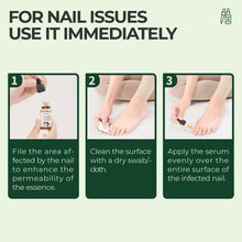Load image into Gallery viewer, Nail Repair Magic Drops