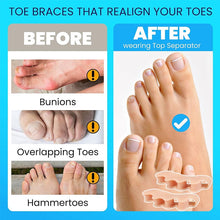 Load image into Gallery viewer, Five-Hole Toe Separators (5 Pairs)