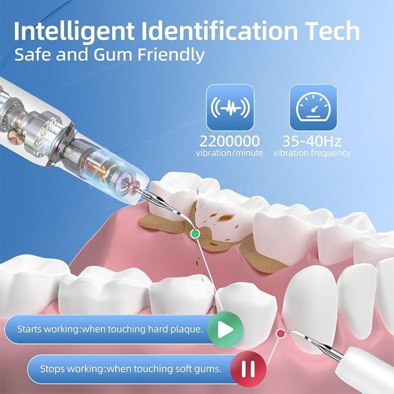 UltraSonic Dental Cleaner