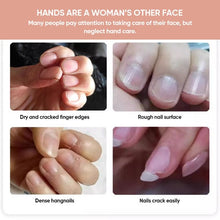 Load image into Gallery viewer, Nails Nutritious Growth Oil (5-piece set)