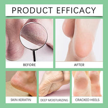 Load image into Gallery viewer, Feet Callus Remover