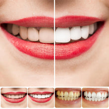 Load image into Gallery viewer, SP-8/SP-10 Probiotic Whitening Toothpaste for Oral Health