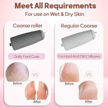 Load image into Gallery viewer, Dual Head Electric Feet Callus Remover