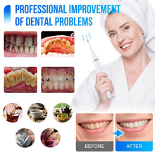 Load image into Gallery viewer, Electric Ultrasonic Tooth Cleaner