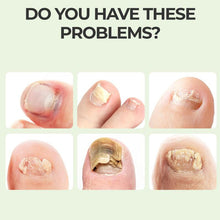Load image into Gallery viewer, Nail Repair Magic Drops