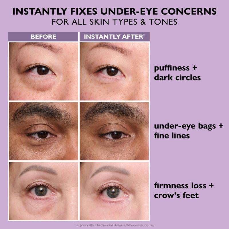 Temporary Eye Tightener