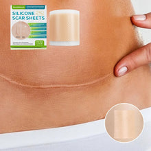 Load image into Gallery viewer, Silicone Wound Decrease Scar Patches