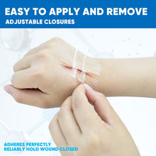 Load image into Gallery viewer, Portable Wound Protection Injury Healing for Outdoor Use Easy (2-strapsx2 pcs/box)