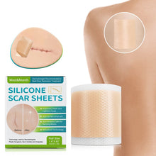 Load image into Gallery viewer, Silicone Wound Decrease Scar Patches