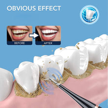 Load image into Gallery viewer, Electric Ultrasonic Tooth Cleaner