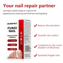 Load image into Gallery viewer, Toenail Fungus Treatment Extra Strength