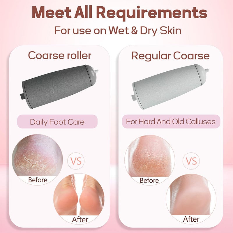Dual Head Electric Feet Callus Remover