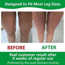 Load image into Gallery viewer, Sakerplus Cellulite Massage Roller