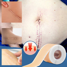Load image into Gallery viewer, Silicone Wound Decrease Scar Patches