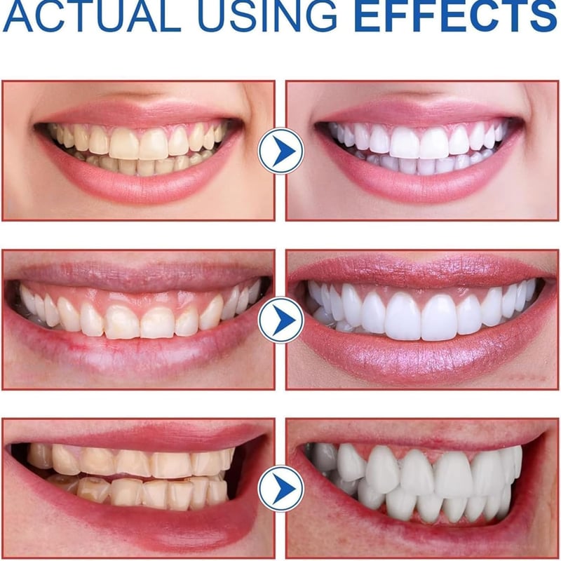 SP-8/SP-10 Probiotic Whitening Toothpaste for Oral Health