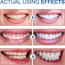 Load image into Gallery viewer, SP-8/SP-10 Probiotic Whitening Toothpaste for Oral Health