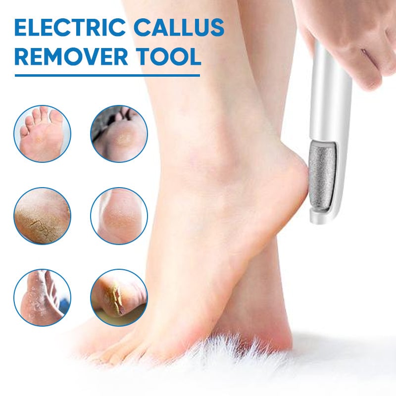 Portable Electric Feet Callus Remover