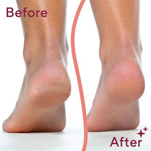 Load image into Gallery viewer, Dual Head Electric Feet Callus Remover