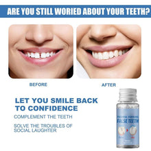 Load image into Gallery viewer, Moldable False Teeth for Temporary Tooth Fillings