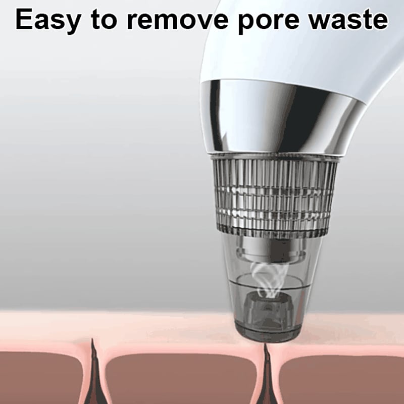 Professional Vacuum Blackhead Remover