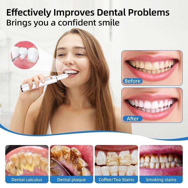 UltraSonic Dental Cleaner