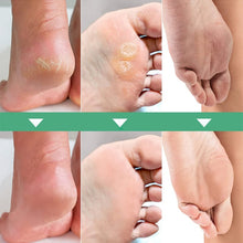 Load image into Gallery viewer, Exfoliating Foot Mask
