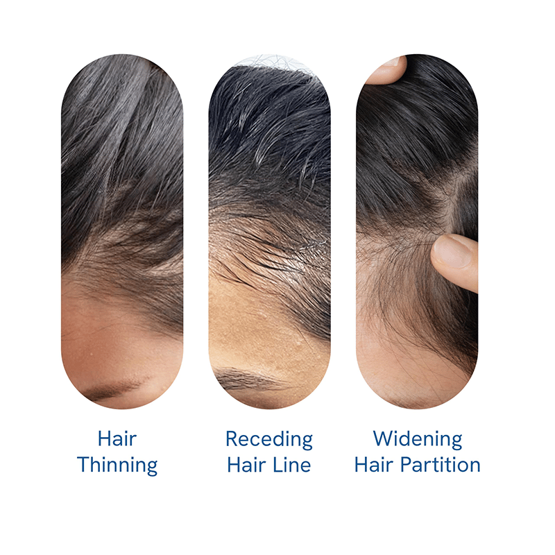 Advanced Hair Growth Roll-On Serum