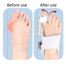 Load image into Gallery viewer, Upgraded Bunion Corrector
