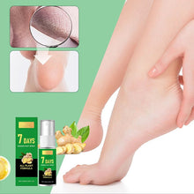 Load image into Gallery viewer, Feet Callus Remover