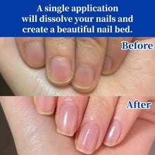 Load image into Gallery viewer, Antifungal Nail Repair Solution