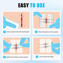 Load image into Gallery viewer, Portable Wound Protection Injury Healing for Outdoor Use Easy (2-strapsx2 pcs/box)