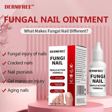 Load image into Gallery viewer, Toenail Fungus Treatment Extra Strength
