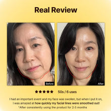 Load image into Gallery viewer, V-line Full Face Tension Lifting Mask (5pcs)