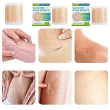 Load image into Gallery viewer, Silicone Wound Decrease Scar Patches