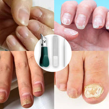 Load image into Gallery viewer, Three Sets Of Eagle Beak Beveled Nail Clippers