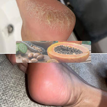 Load image into Gallery viewer, Exfoliating Foot Mask