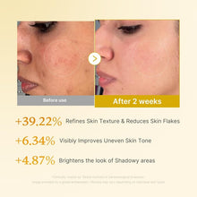 Load image into Gallery viewer, Kojic Acid Turmeric Toner for Face &amp; Body