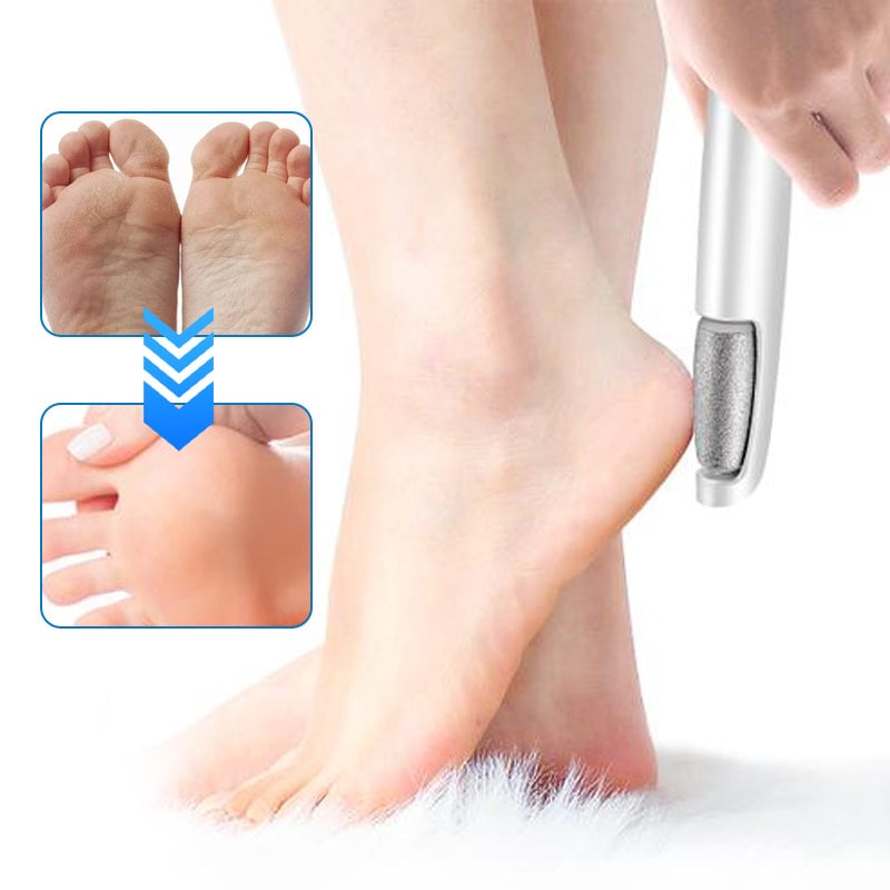 Portable Electric Feet Callus Remover