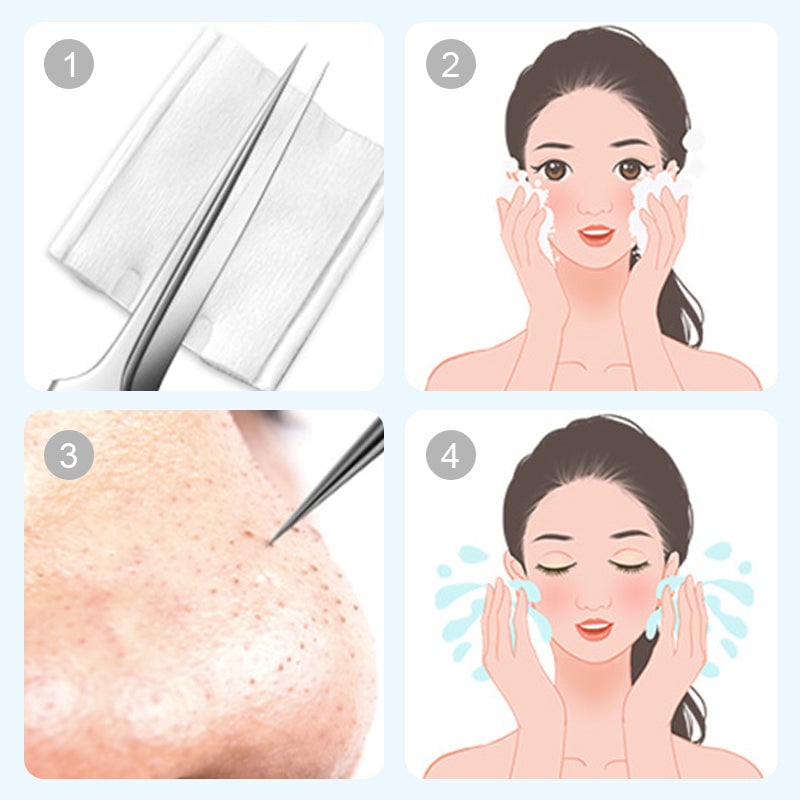【Up to 50% OFF】Stainless Steel Blackhead Remover Tool Kit