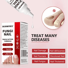 Load image into Gallery viewer, Toenail Fungus Treatment Extra Strength