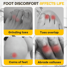 Load image into Gallery viewer, Silicone Anti-Friction Toe Protector