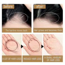 Load image into Gallery viewer, 🧴🪮Anti-Hair Fall Hair Loss Shampoo