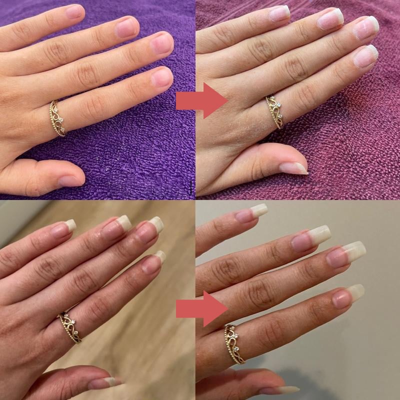 Nails Nutritious Growth Oil (5-piece set)