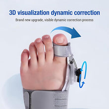 Load image into Gallery viewer, Upgraded Bunion Corrector
