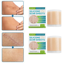 Load image into Gallery viewer, Silicone Wound Decrease Scar Patches