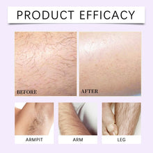 Load image into Gallery viewer, Gentle Body Hair Removal Kit