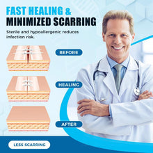 Load image into Gallery viewer, Portable Wound Protection Injury Healing for Outdoor Use Easy (2-strapsx2 pcs/box)