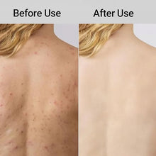 Load image into Gallery viewer, New Exfoliating Shower Towel